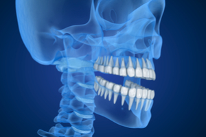 Cephalometric Orthodontic Xrays Near Me LabFinder